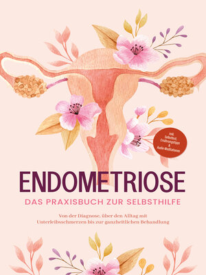 cover image of Endometriose--Das Praxisbuch zur Selbsthilfe
